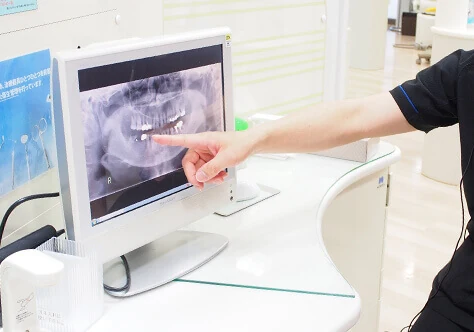 口腔内・かみ合わせのチェックイメージ